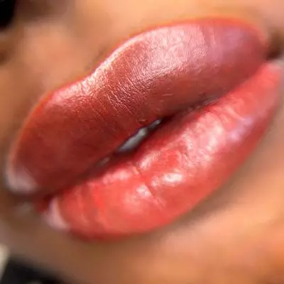 Dark Lips Neutralization