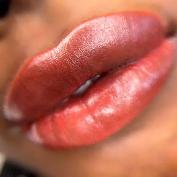 Dark Lips Neutralization